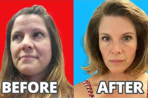 5 things my face tells you about insulin resistance